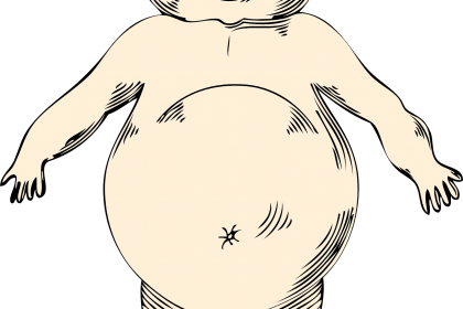 fat child obesity