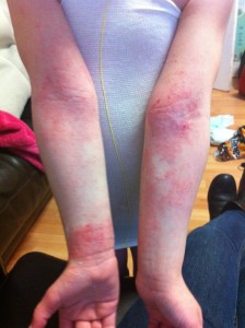 ok lauren before skin shop testimonial