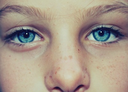 eye-freckles