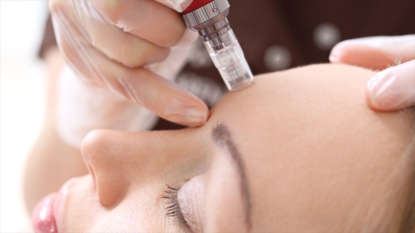 reasons to try microneedling