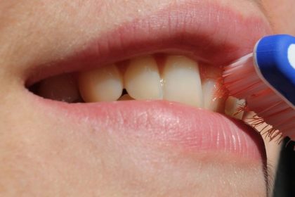When you have an orthodontic device like metal braces, maintaining good oral hygiene can be a little more complicated. Wearers may be worried about bad breath and plaque build-up more than ever before, and it’s all for a good reason.