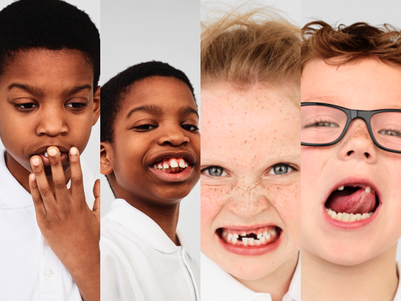Wonky teeth causing confidence crisis amongst UK kids