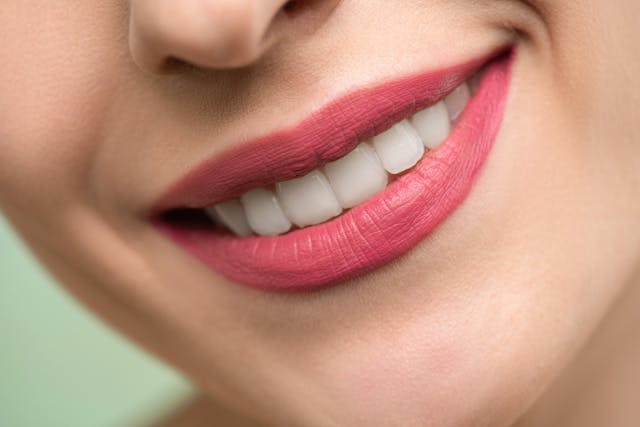Everything you need to know about veneers