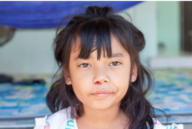 Learning first aid for toddlers nose bleed